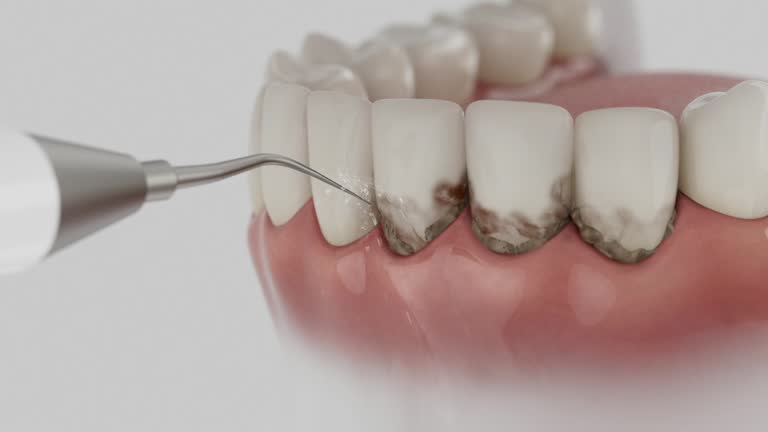 Reliable Tooth Extraction contractor in Cameron, TX by Smile Center Dentistry